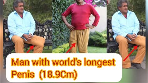 world biggest penis|Man with worlds largest penis says its still growing